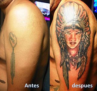 <span class="mw-page-title-main">Cover-up tattoo</span> Tattooing over a tattoo or scar