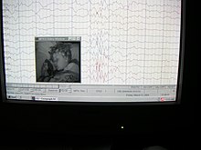EEG record of brain activity and wave patterns from a sleeping boy. EEG record of brain activity and wave patterns from a sleeping boy.jpg