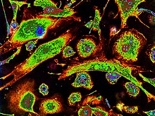 Epithelioid cells (polarized form, nucleus color - green) and macrophages (nucleus color - red) in peritoneal cell culture of mice, stimulated by inactivated Mycobacterium tuberculosis, on the 10th day of cultivation. The pseudo color image was obtained by color coding of different optical densities in a photo of cells, stained by Azure-Eosine. The shape of cells is determined by their cytoskeleton, and the color characterizes their different cytomorphology. Epithelioid cells and macrophages in cell culture.jpg