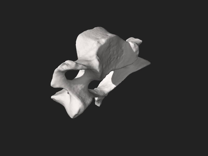 File:Human cervical vertebra.stl