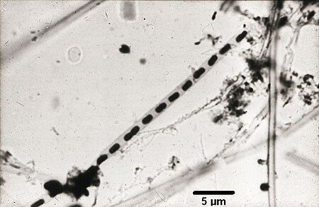 Leptothrix lichtmikroskopisch.jpg