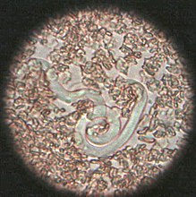 Spiruridae Dirofilaria immitis Microfilaria.jpg