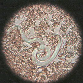bronstein parazita