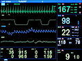 Vorschaubild der Version vom 19:54, 10. Feb. 2012