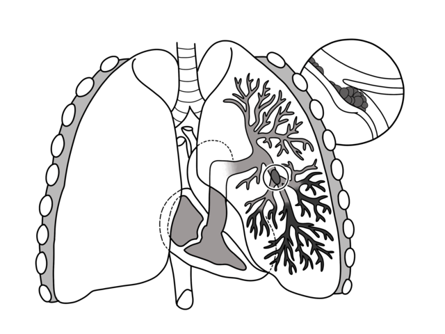 Chapter II: The Hospital, The Mimic Wiki