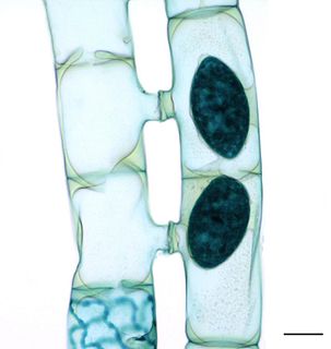 Zygnematophyceae Class of algae