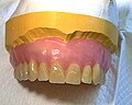 Miniatura para Prótesis dental