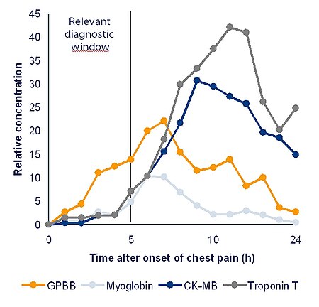 Tập_tin:CardiacMarkerComparison.JPG