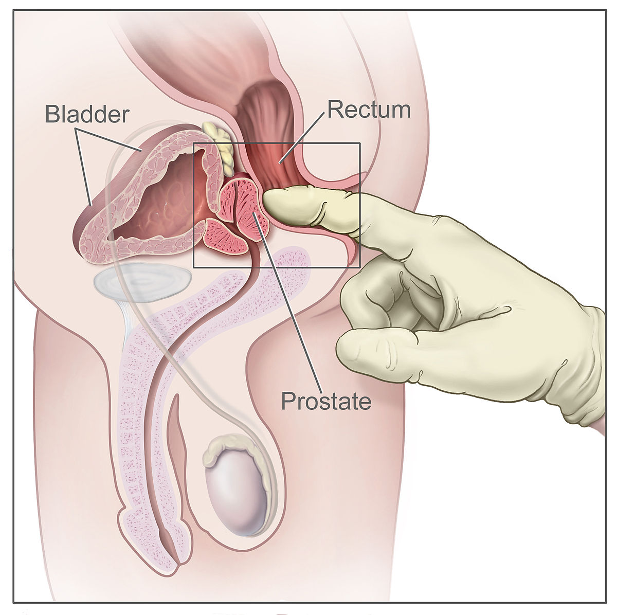 Prostate orgasm instructions
