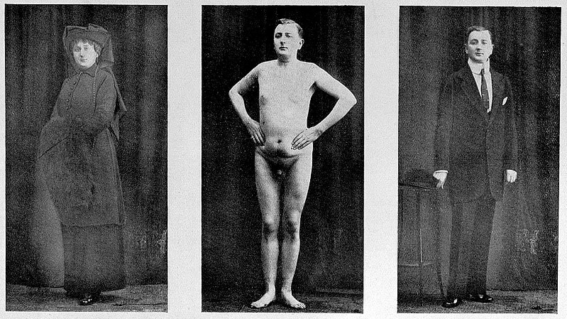 File:Dr. Magnus Hirschfeld; Sexualpathologie Wellcome L0025695 (cropped).jpg