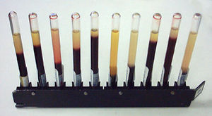 Erythrocyte sedimentation