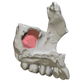 Maxillary sinus - medial view.png