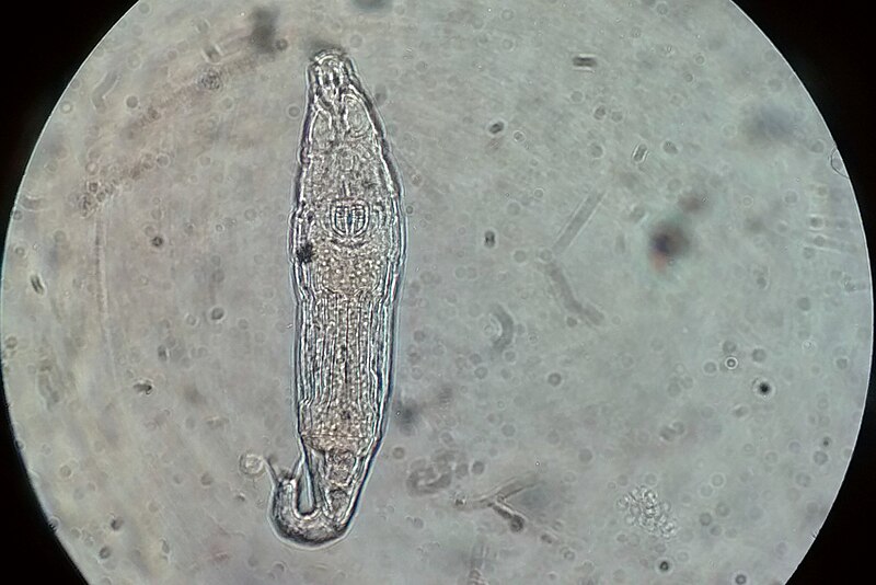 File:Philodina sp. (Classː Bdelloidea) - Rotifera.jpg