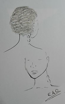 A sketch of two women suffering with lumps on the sides of their necks