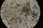 Miniatura para Taphrinomycetes