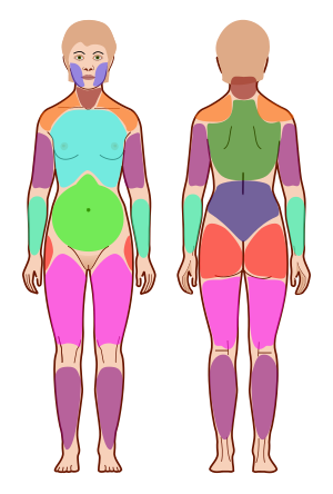 Widespread Pain Index Areas.svg