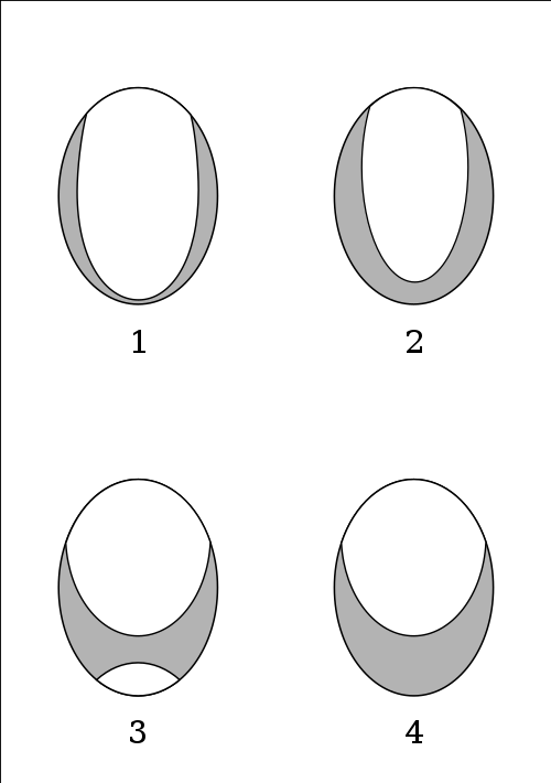 Schematic linguograms of 1) apical, 2) upper apical, 3) laminal and 4) apicolaminal stops based on Dart (1991:16), illustrating the areas of the tongue in contact with the palate during articulation (shown in grey)
