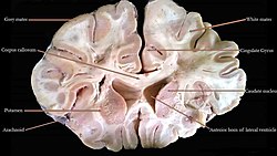 Cut section of human brain.jpg