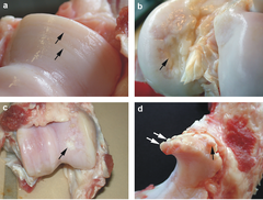 Damaged cartilage from sows. (a) cartilage erosion (b)cartilage ulceration (c)cartilage repair (d)osteophyte (bone spur) formation.