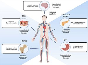 Different locations of the body that are affected by autoimmune diseases