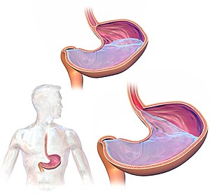 GastroEsophageal Reflux Disease (GERD).jpg