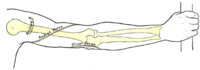 A extremidade superior direito, mostrando superfície inscrições para os ossos e nervos.