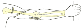 Cubital tunnel