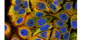 TRIAP1 regulats P53 expression in HTC116 mitochodrial compartiments. (int.) GAbderrahmane 15.0 5.417 out of 10, SD 2.345