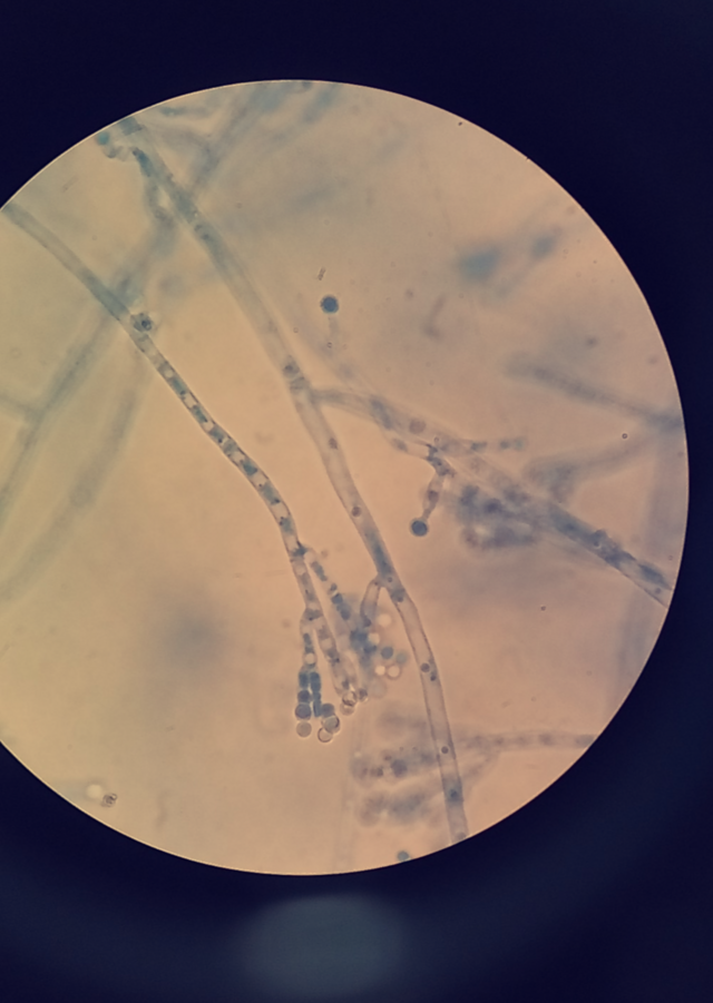 Chrysogenum penicillium Penicillium: A