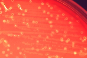 Streptococcus anginosus colonies on blood agar