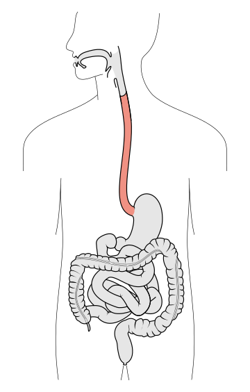 Hestegorri