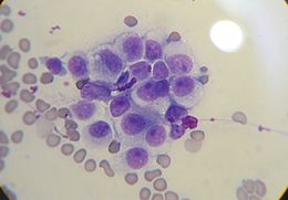 Description de l'image Canine transmissible venereal tumor cytology.JPG.