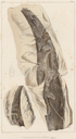 Fossil of the Carboniferous shark Ctenacanthus Ctenacanthus major Agassiz.png