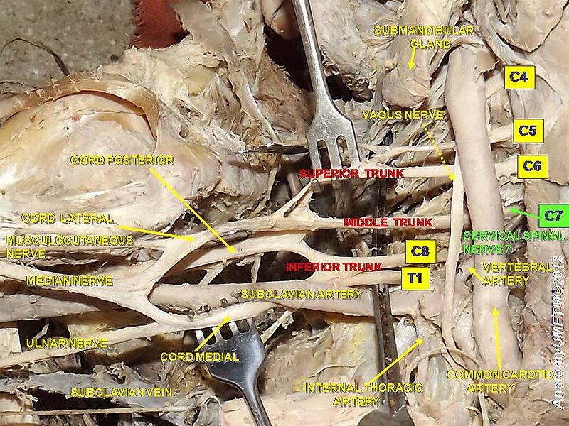 File:Slide4y.JPG