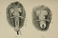 Surgical and obstetrical operations (1907) (14780430331).jpg