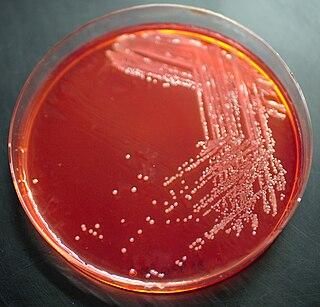 <i>Yersinia hibernica</i> Species of bacterium