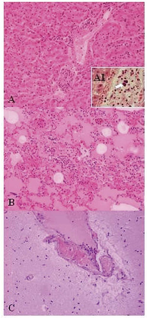 Lactic acid bacteria