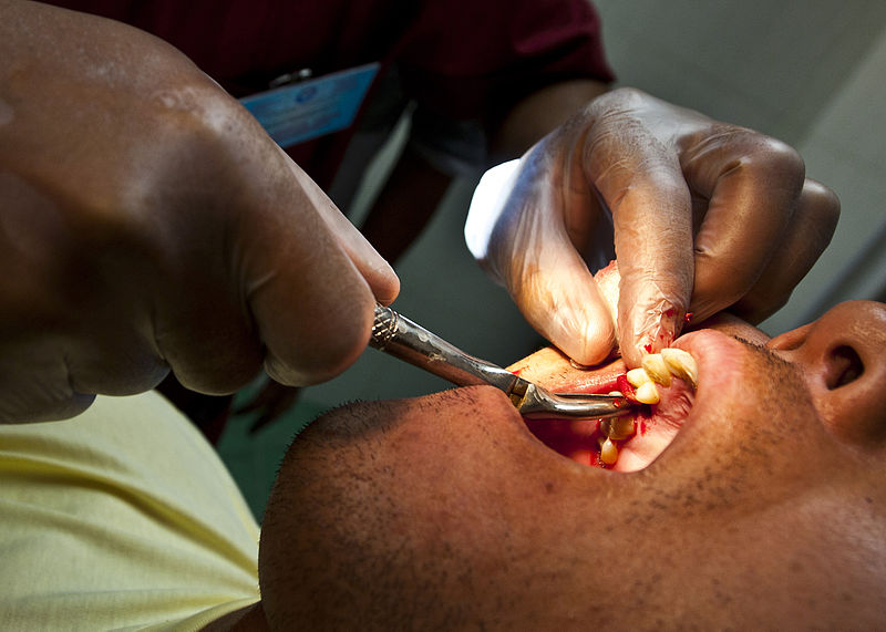 File:A dentist conducts an oral extraction procedure.JPG