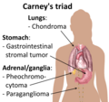 Thumbnail for Carney's triad