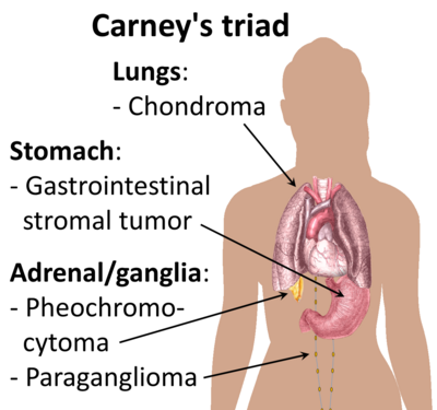 Carney's triad