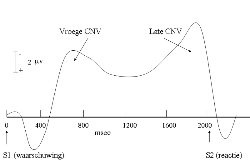 File:Contingent negative variation (CNV) with Dutch text.png