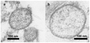 Transmission electron microscopy of purified exosomes. Exosomas vesiculas Cardiomiocito.png