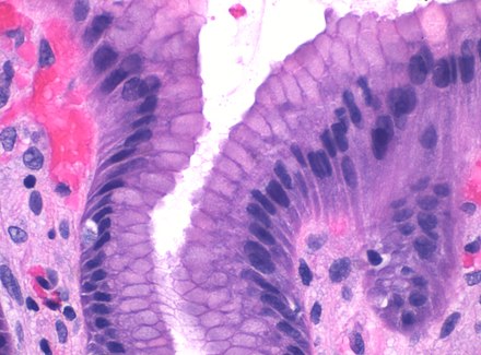 Foveolar cells in the antrum of stomach. A skewed cross-section of the columns gives a false impression of being stratified epithelium.