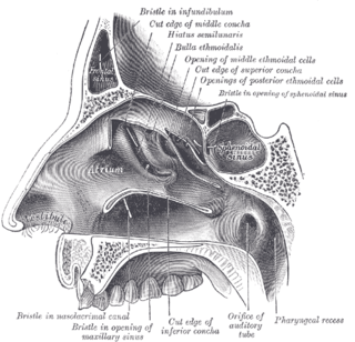 <span class="mw-page-title-main">Sphenoid sinus</span> One of the four paired paranasal sinuses