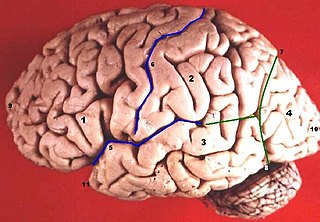 Preoccipital notch Part of the human brain