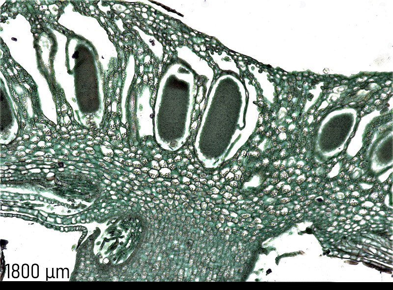 File:Marchantia antheridium mosbo6.jpg