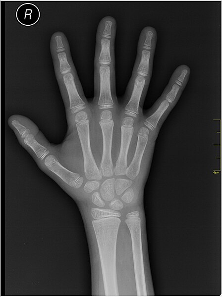 File:Medical X-Ray imaging VHU07 nevit.jpg