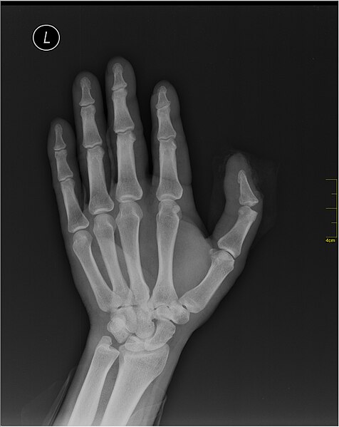 File:Medical X-Ray imaging WIN07 nevit.jpg
