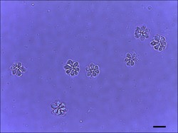 Parasite150085-fig2 Kudoa septempunctata spores from olive flounder (Paralichthys olivaceus).tif