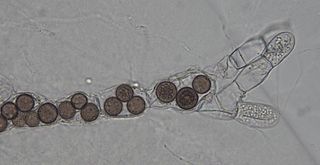 <span class="mw-page-title-main">Rozellida</span> Clade of microscopic fungi